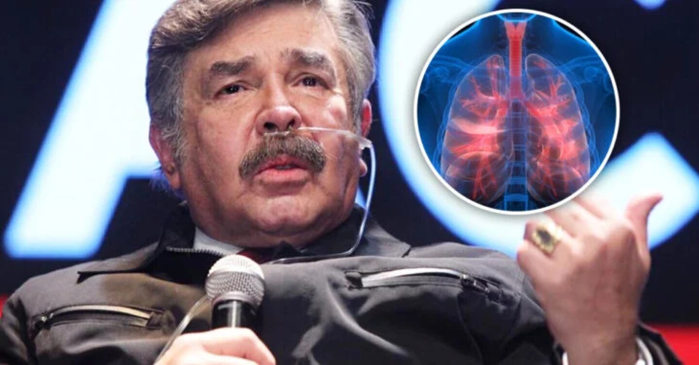 Jorge Ortiz de Pinedo y trasplante de pulmón