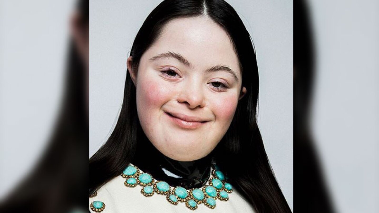 Ellie Goldstein tiene Síndrome de Down y modela para Gucci.