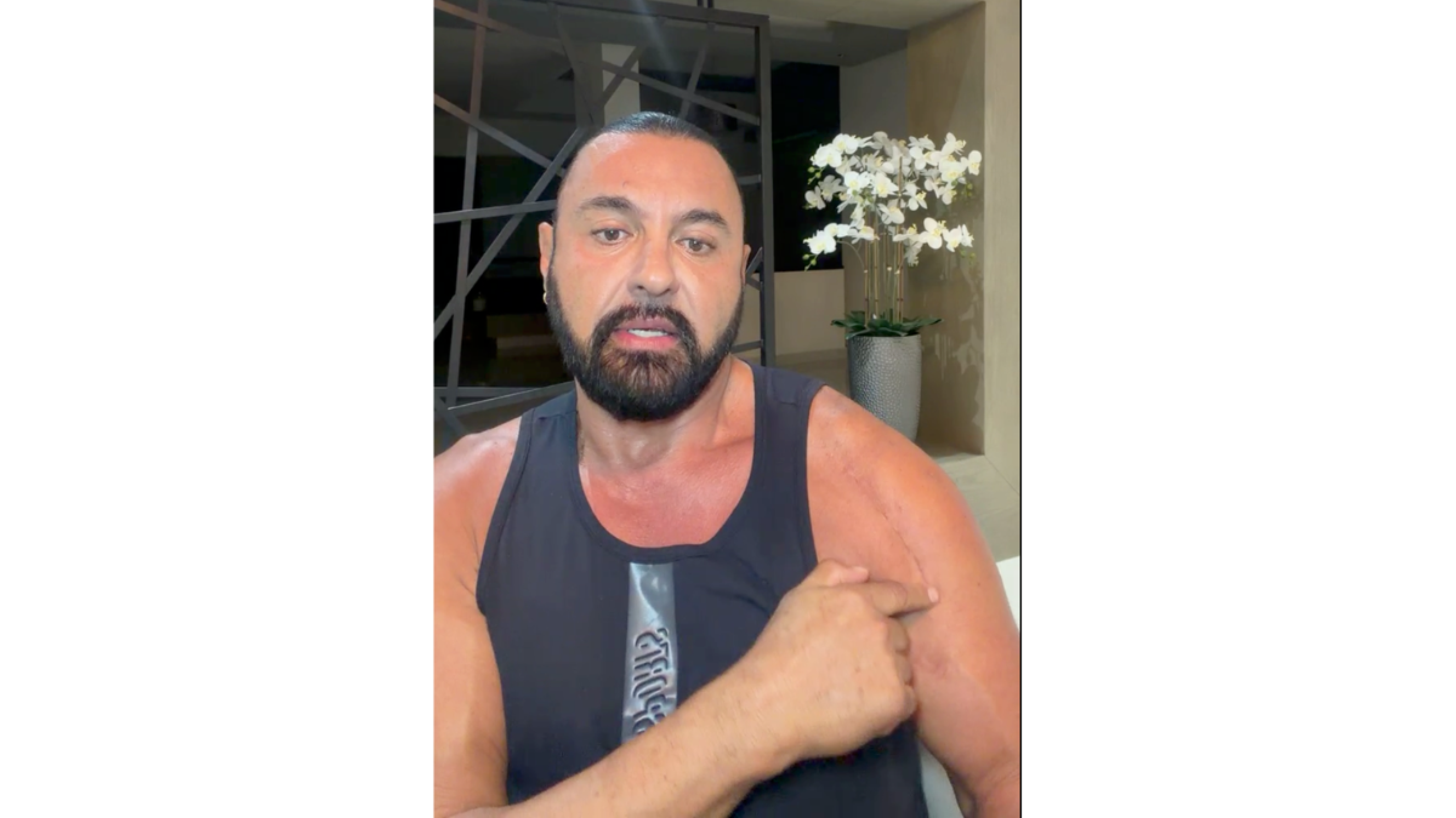 Latin Lover cirugp