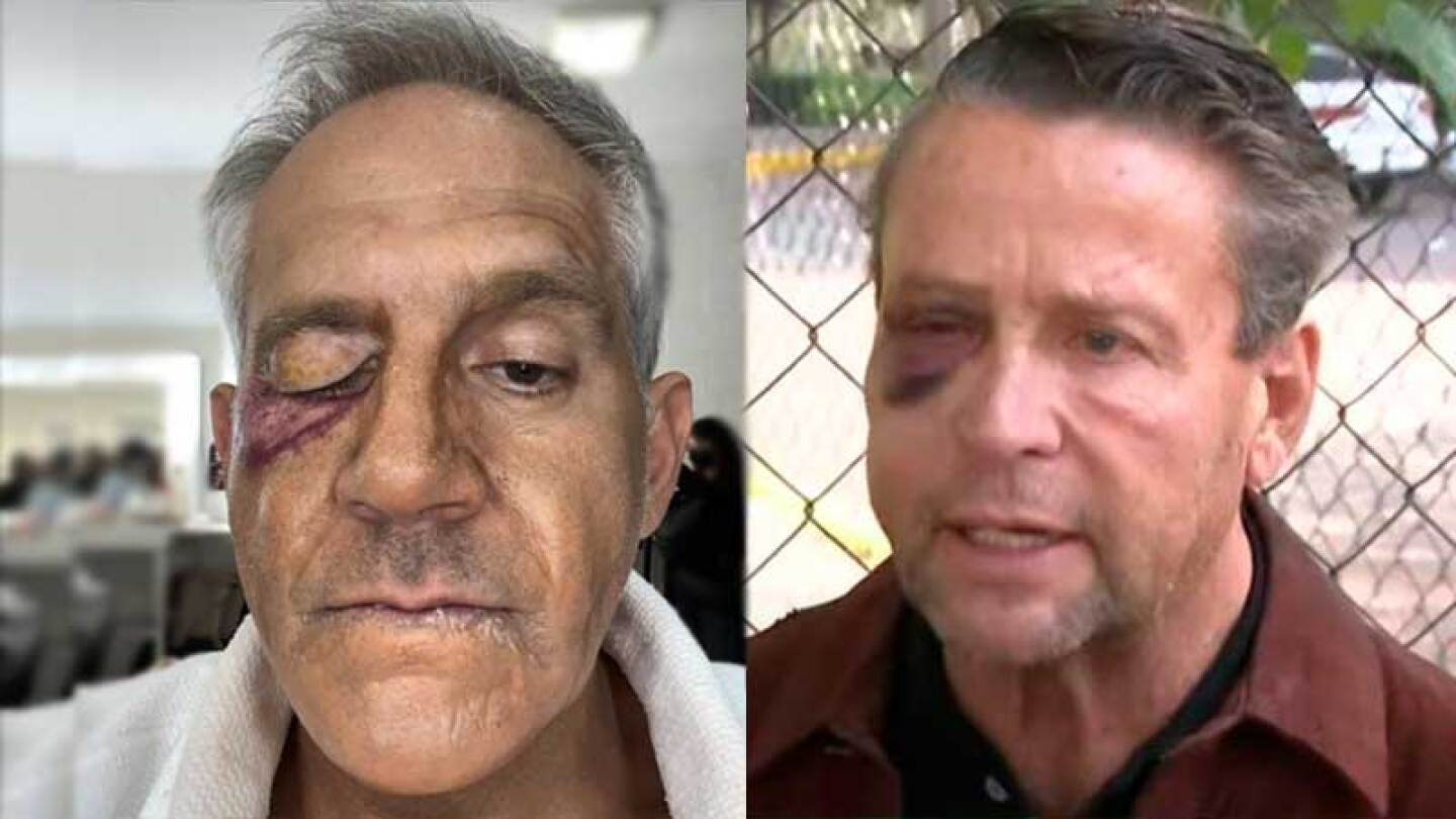 Arath De la Torre imita a Alfredo Adame tras problemas de salud