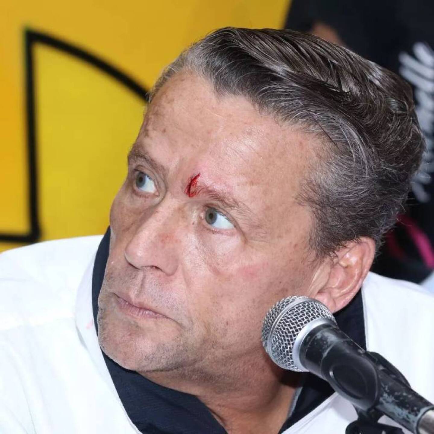 Alfredo Adame con una pequeña herida en plena conferencia tras ser golpeado