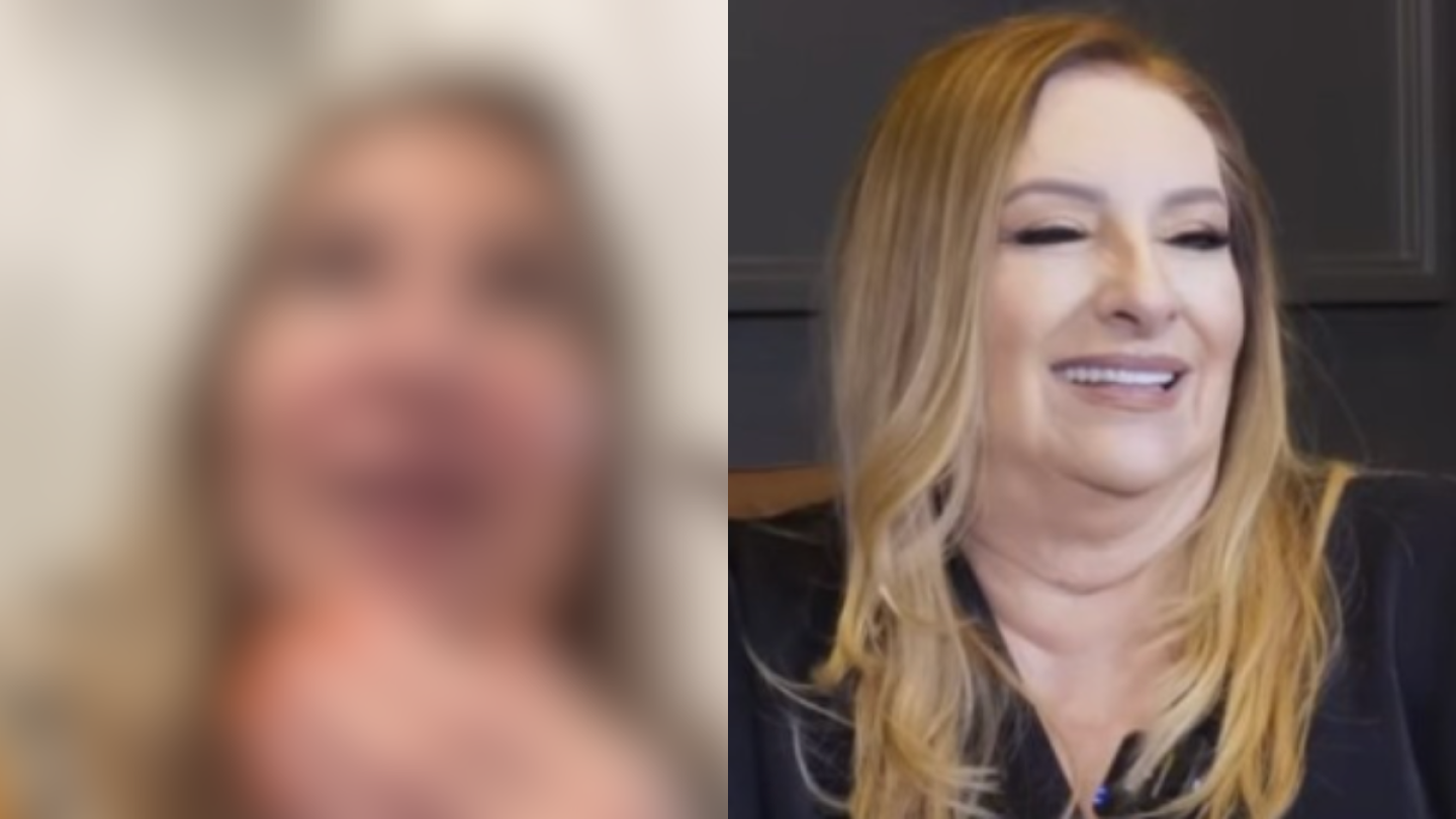Doña Lety se somete a tratamiento estético, así luce ahora