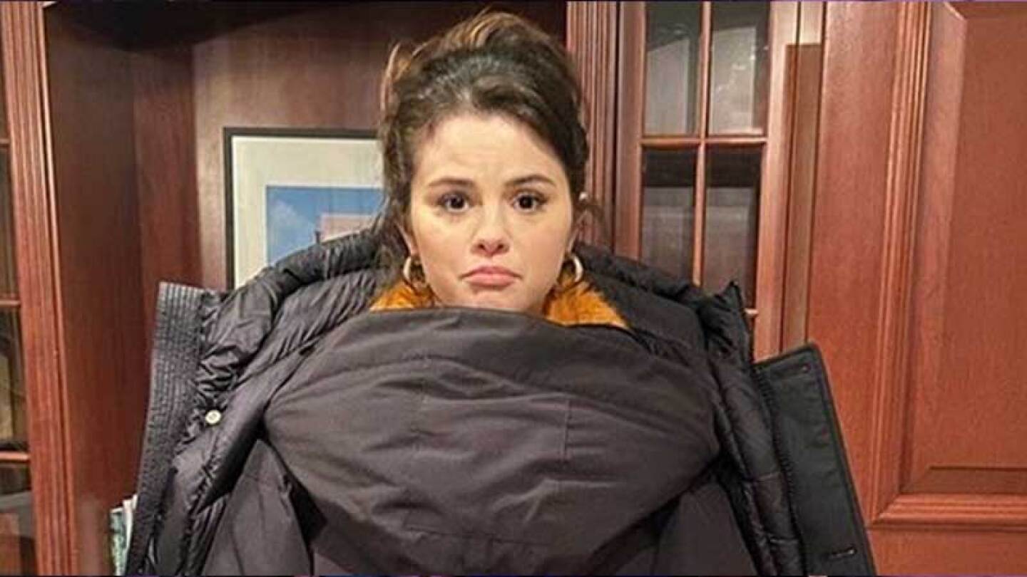 Selena Gómez tuvo una reacción a un autobronceador