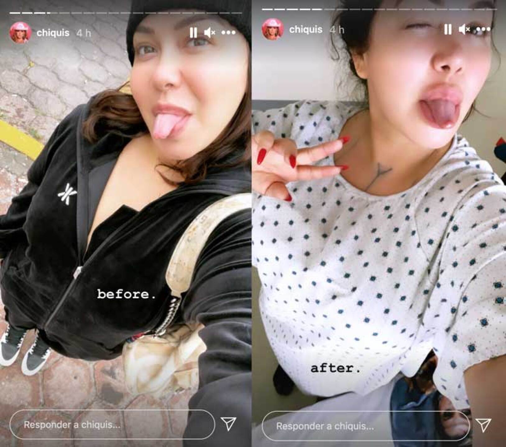 chiquis rivera cirugía busto fotos antes y después