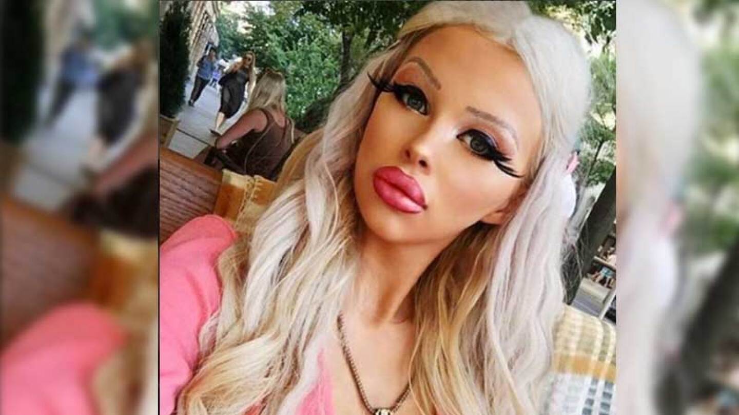 Quiere ser una Barbie pero ¡quien menos te imaginas le paga las cirugías!