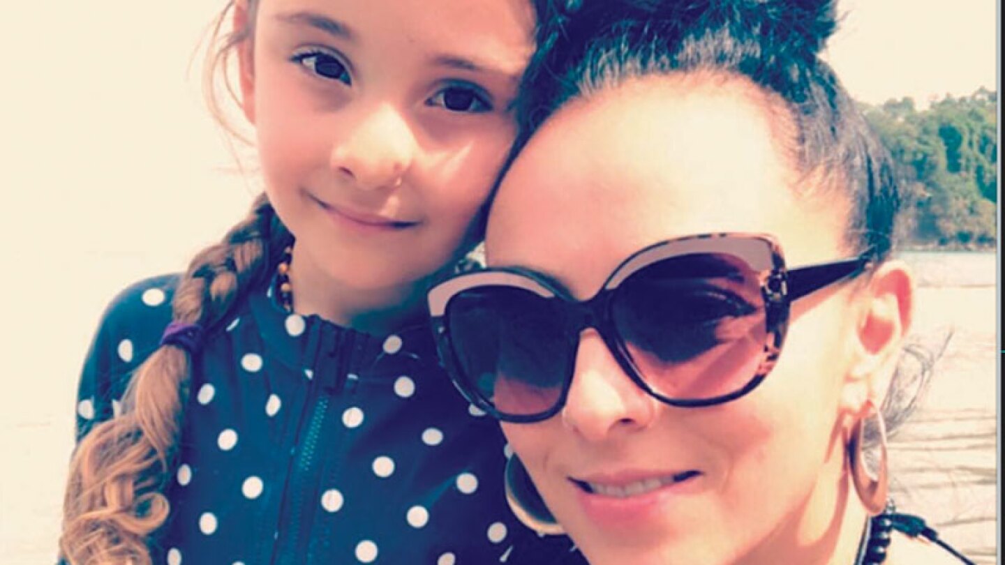 Ivonne Montero nos cuenta que su hija quiere que le quiten el quiste de su nariz