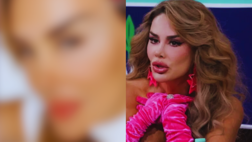 Ninel Conde se somete a cirugía considerada "riesgosa" para cambiar una parte de su cuerpo. ¿Qué se hizo?
