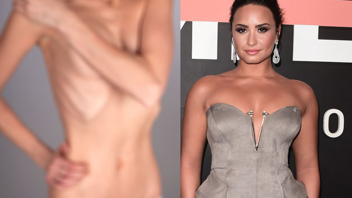 Filtran impresionante foto de Demi Lovato cuando tenía anorexia