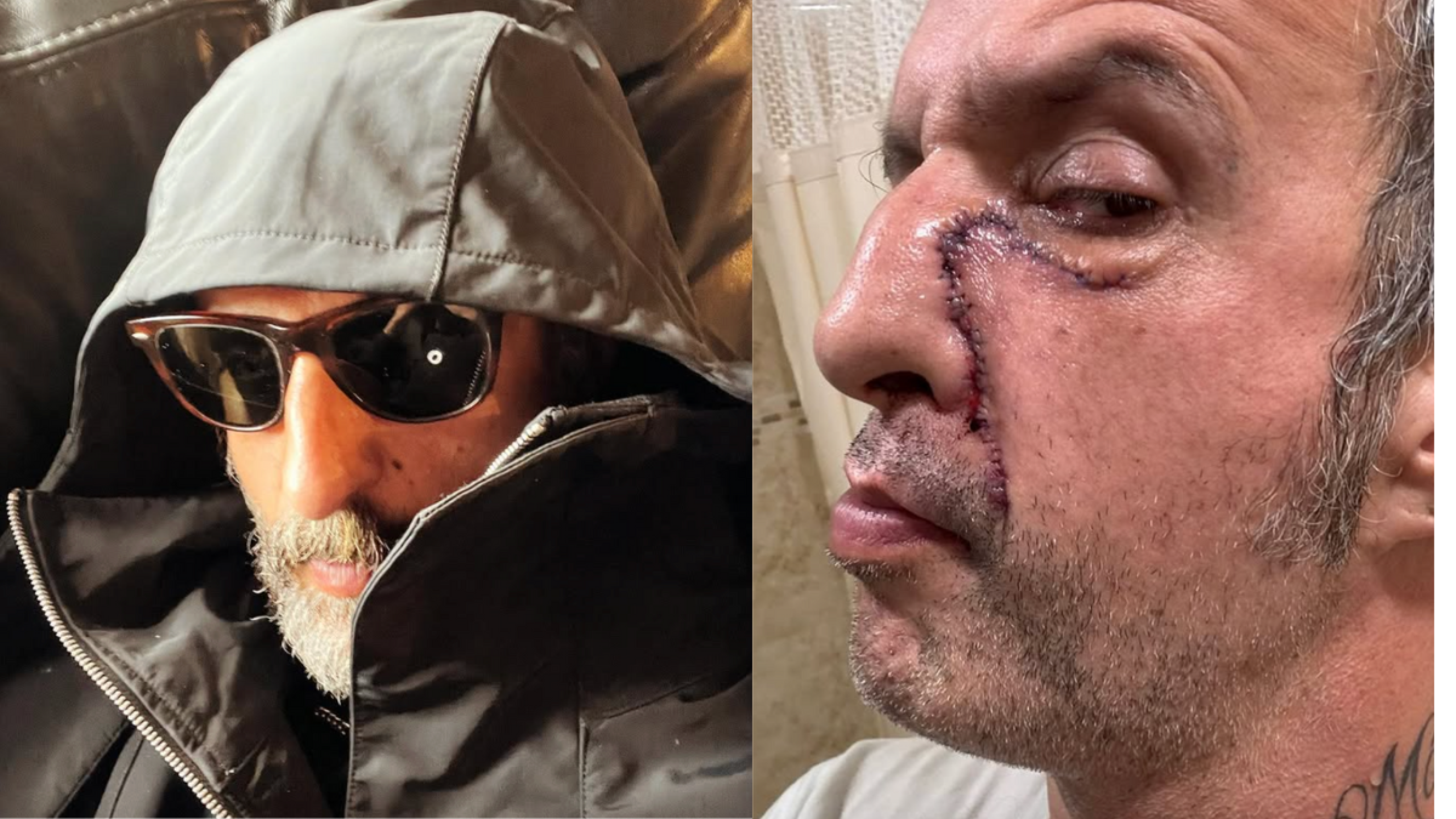 Ismael Fuentes, Tito, de Molotov, comparte fotografía tras 11 cirugías en el rostro por adicciones