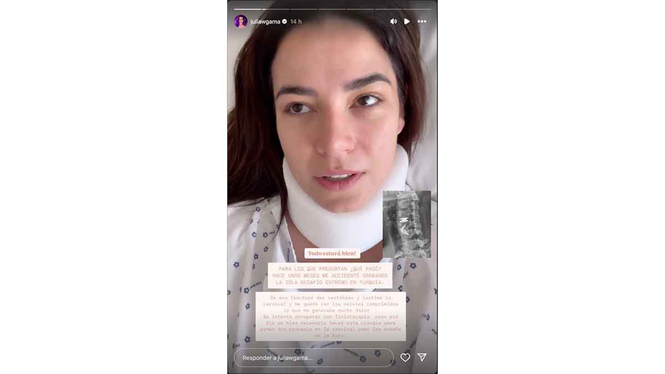 Julia Gama se sometió una cirugía