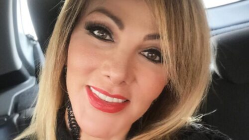 Olivia Collins sube foto de cómo quedó su pie, tras tremenda caída