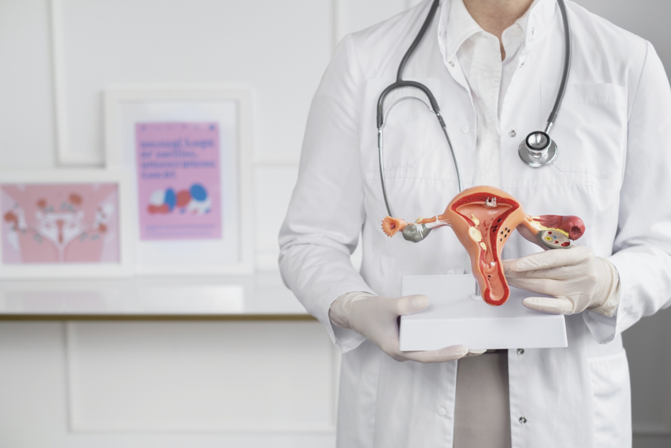 Síntomas del Cáncer Ovario