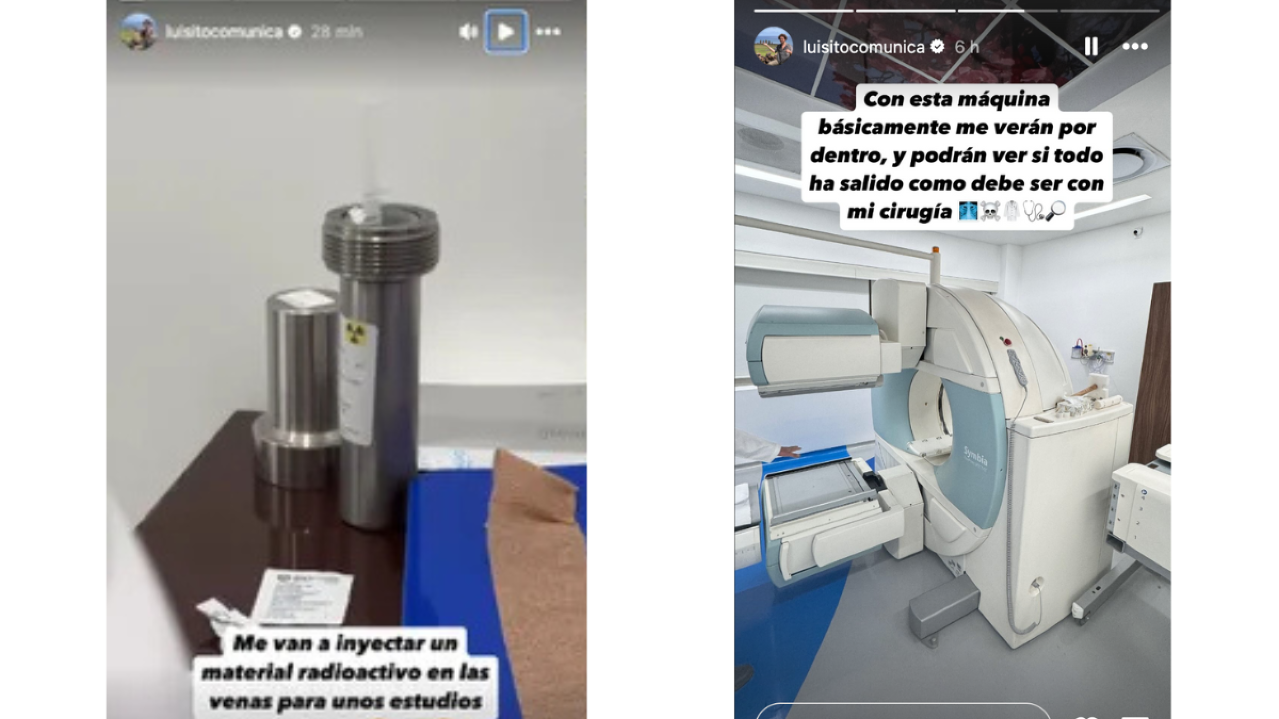 Luisito Comunica se somete a cirugía de columna y recibe tratamiento con material radioactivo