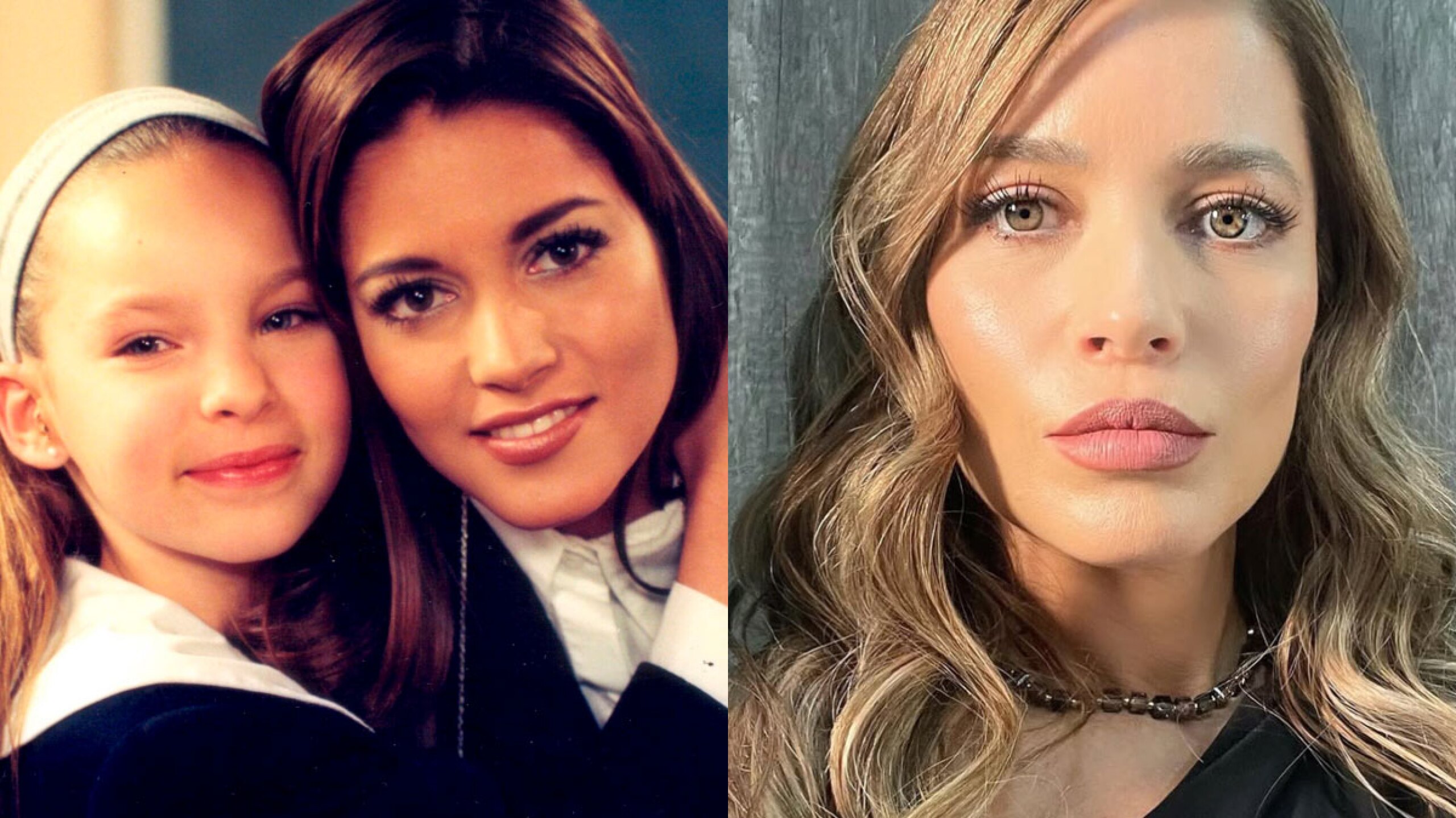 Adriana Fonseca en Amigos por siempre antes y después