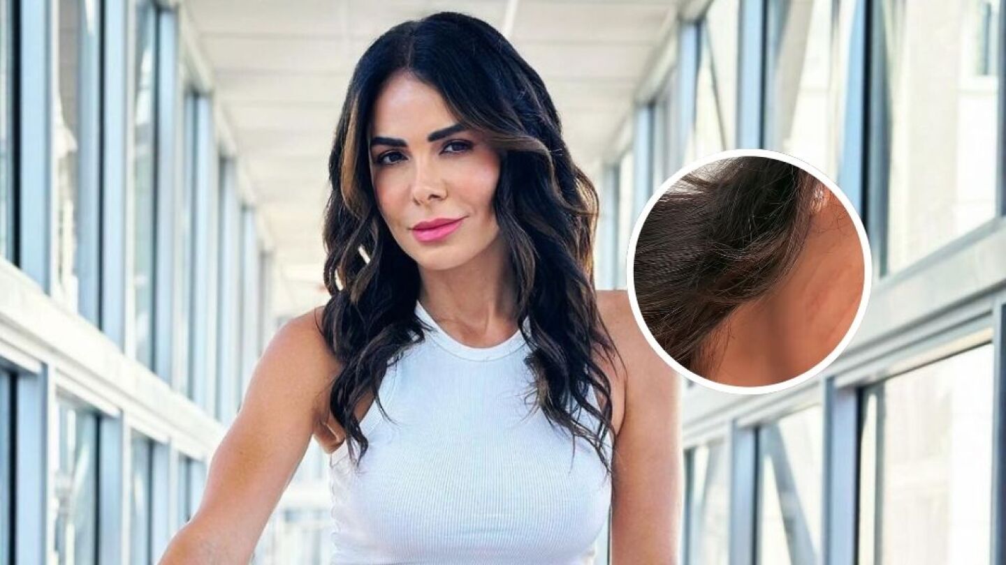 Vanessa Arias sufre rasguños