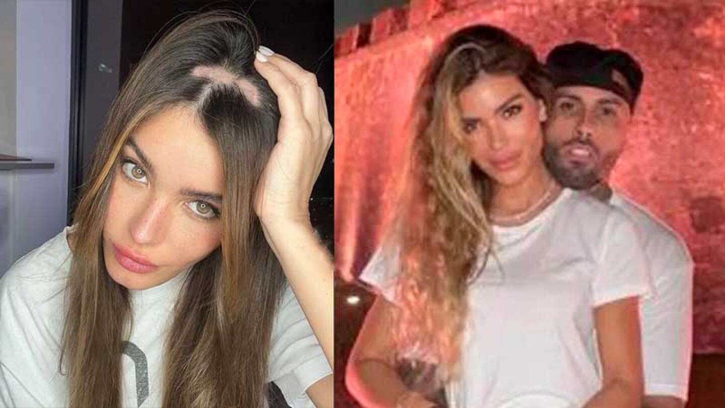 Aleska Génesis se sincera sobre el uso de peluca