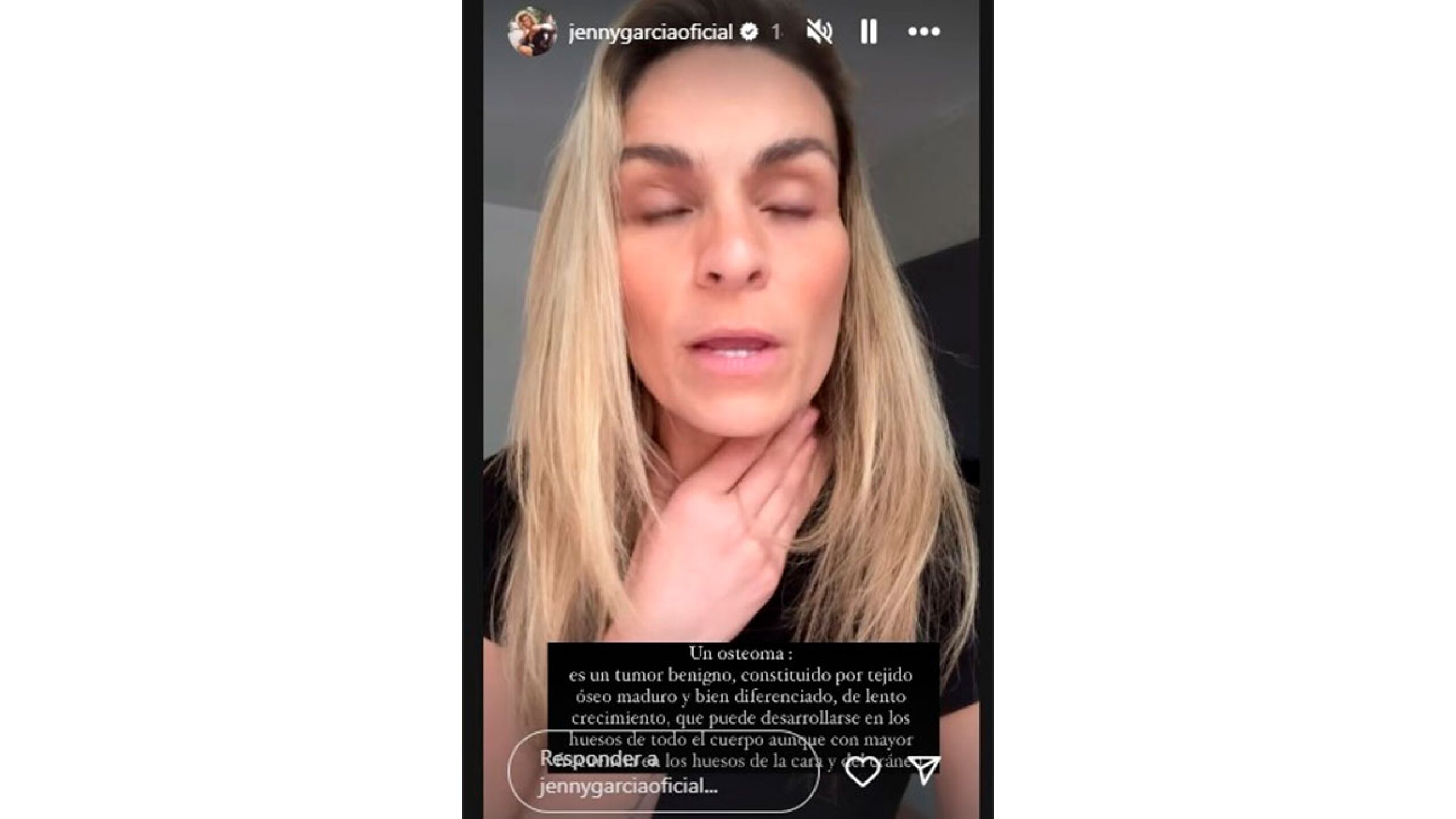 Jenny García dice que tiene un tumor