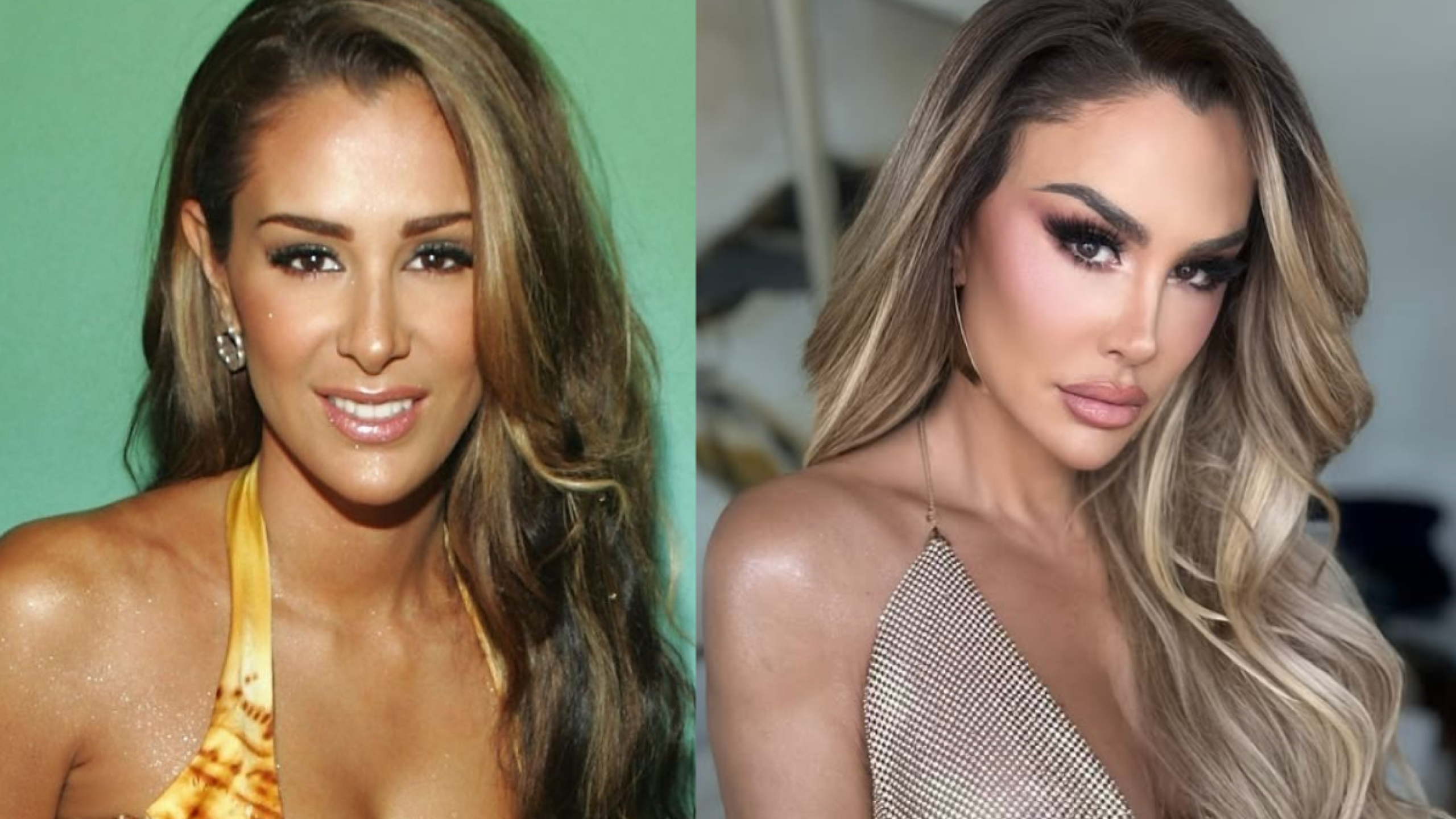 Ninel Conde se ha sometido a diversas cirugías estéticas; así luce actualmente