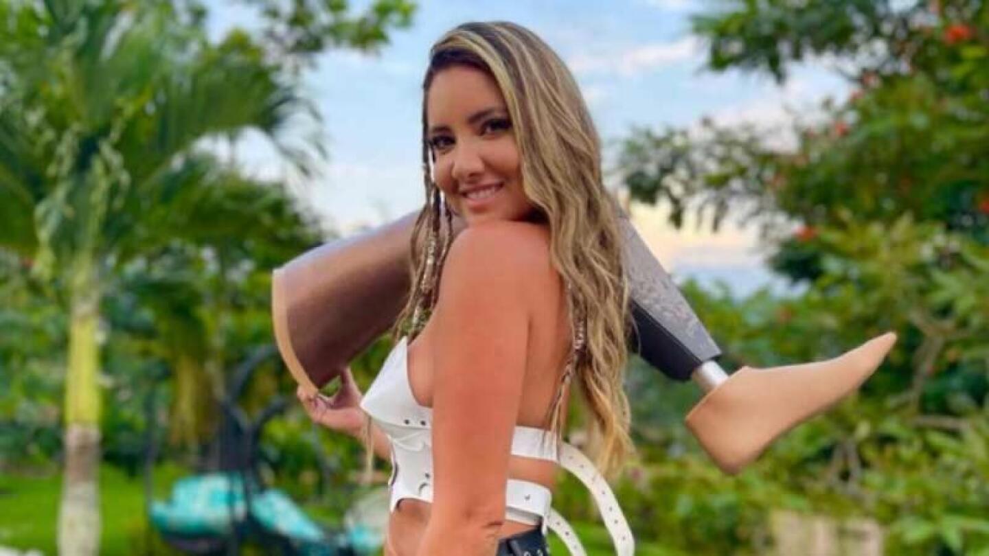 Daniella Álvarez tendrá una nueva prótesis