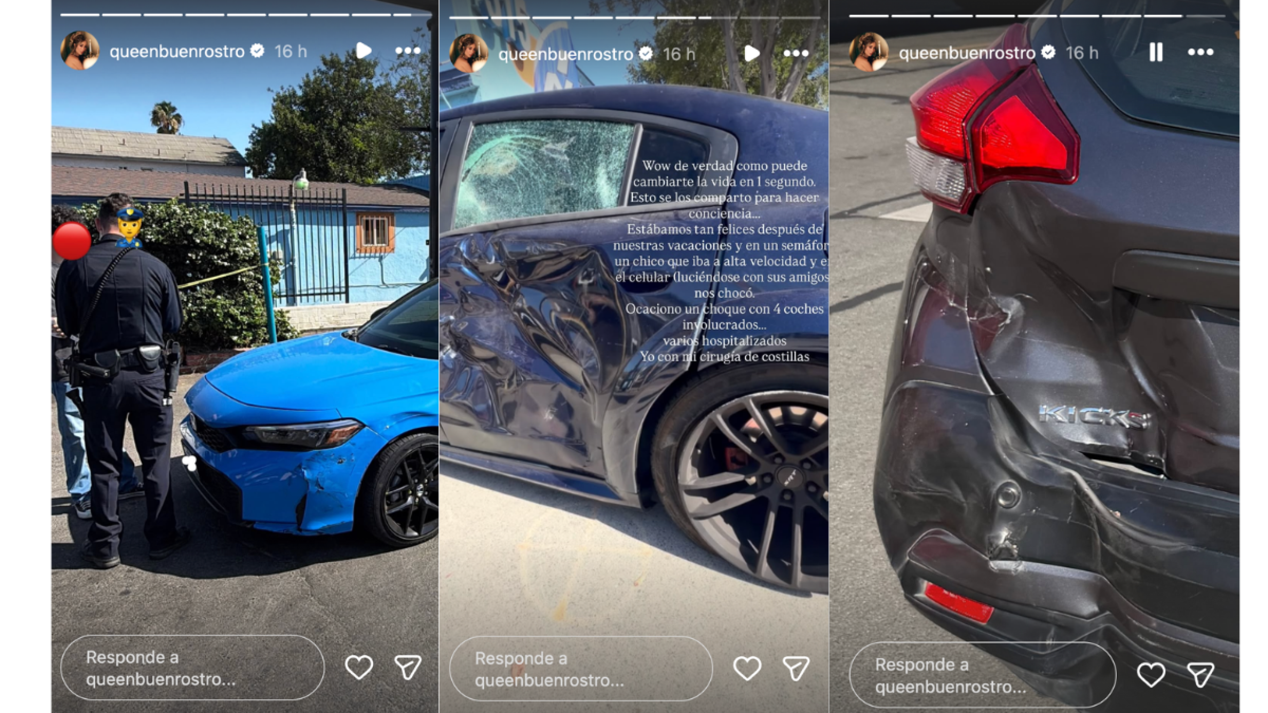 Queen Buenrostro comparte fotos de su accidente.