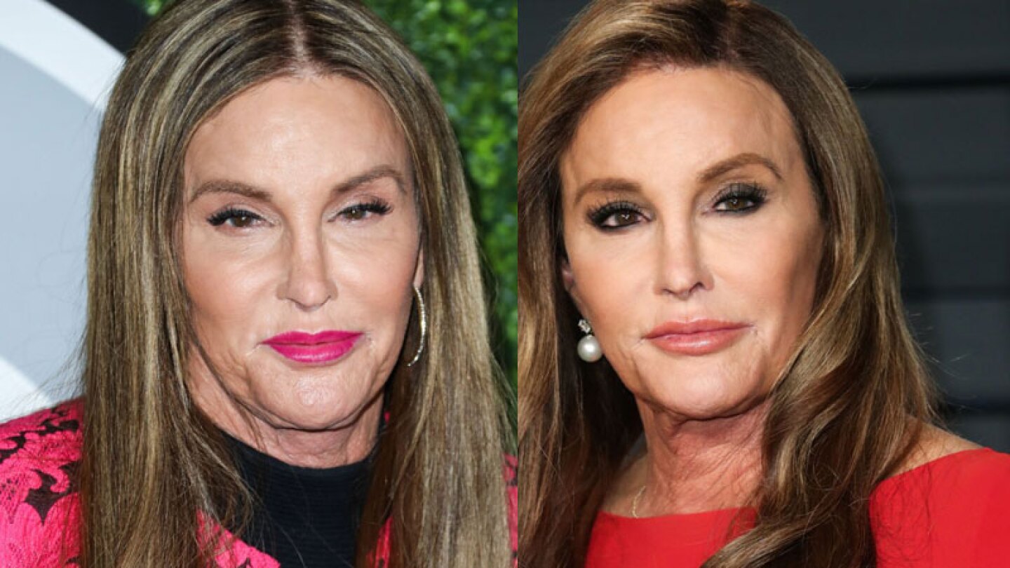 Rayos del Sol le destruyen la nariz a Caitlyn Jenner y muestra impactante foto 