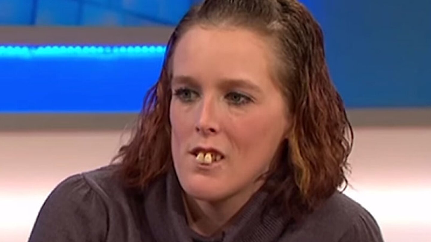La chica de los dientes n.
