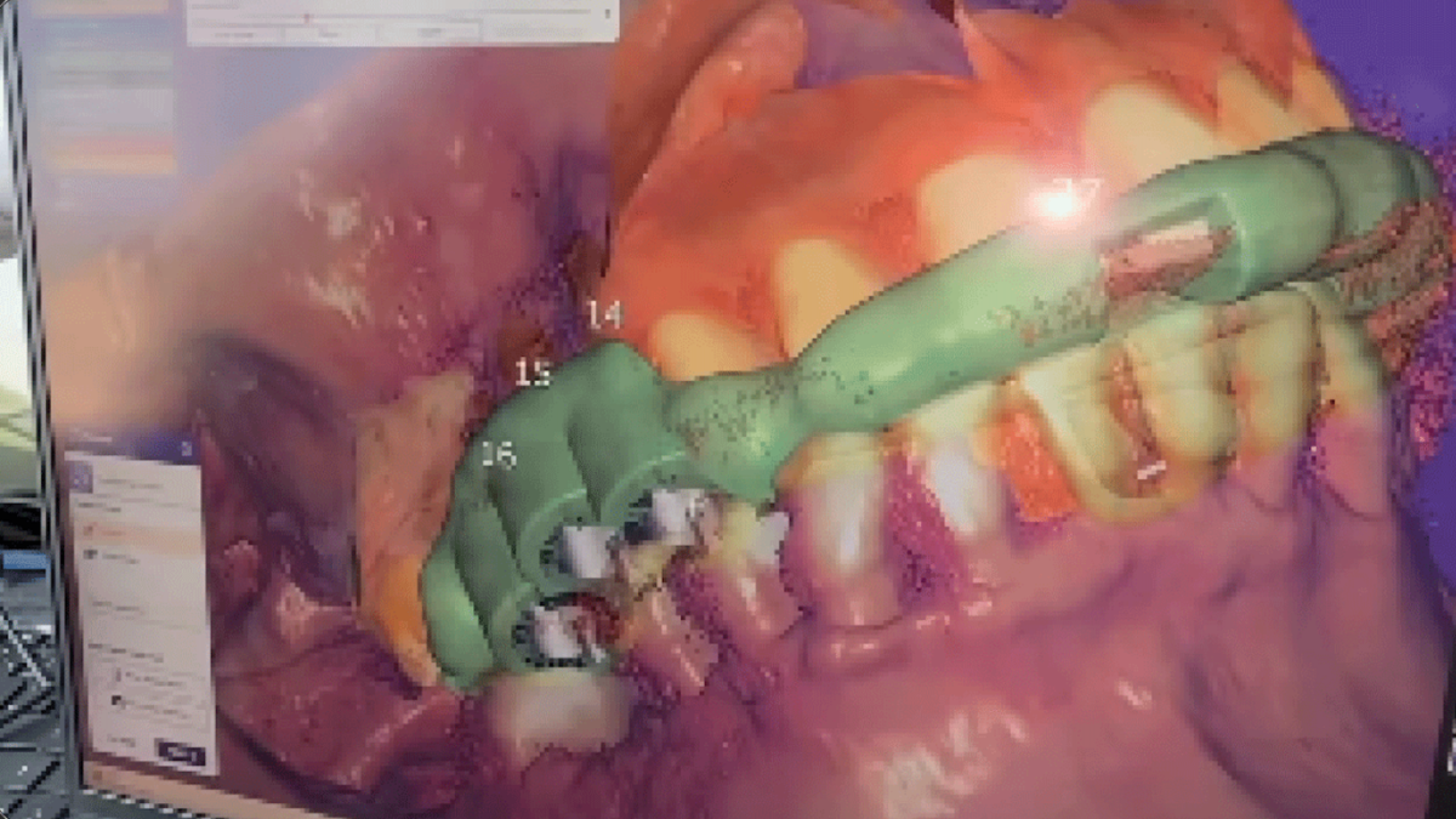 Daño dental de Luis Fernando Peña