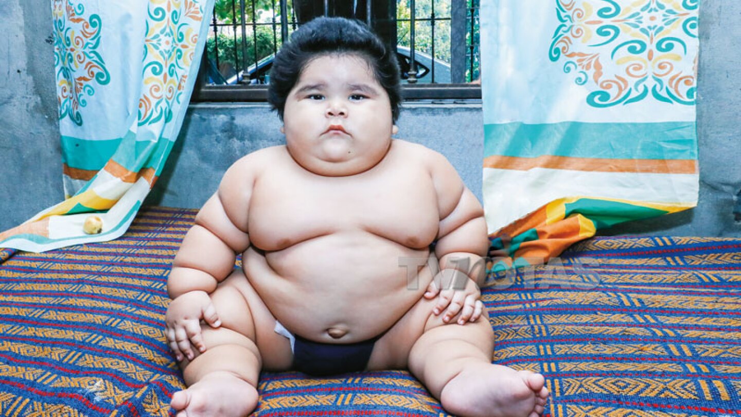 ¡10 meses y 28 kg!… Luisito subre 4 kg al mes y los médicos no saben por qué