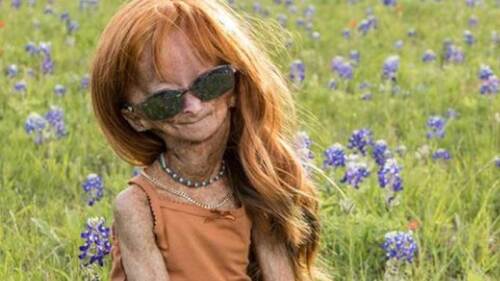 Muere Adalia Rose Williams, la youtuber que inspiró la película de Benjamin Button