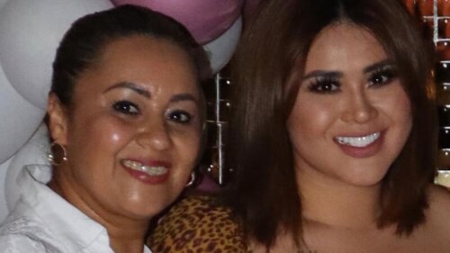 ¡Lo volvió a hacer! La mamá de Gomita se operó el rostro