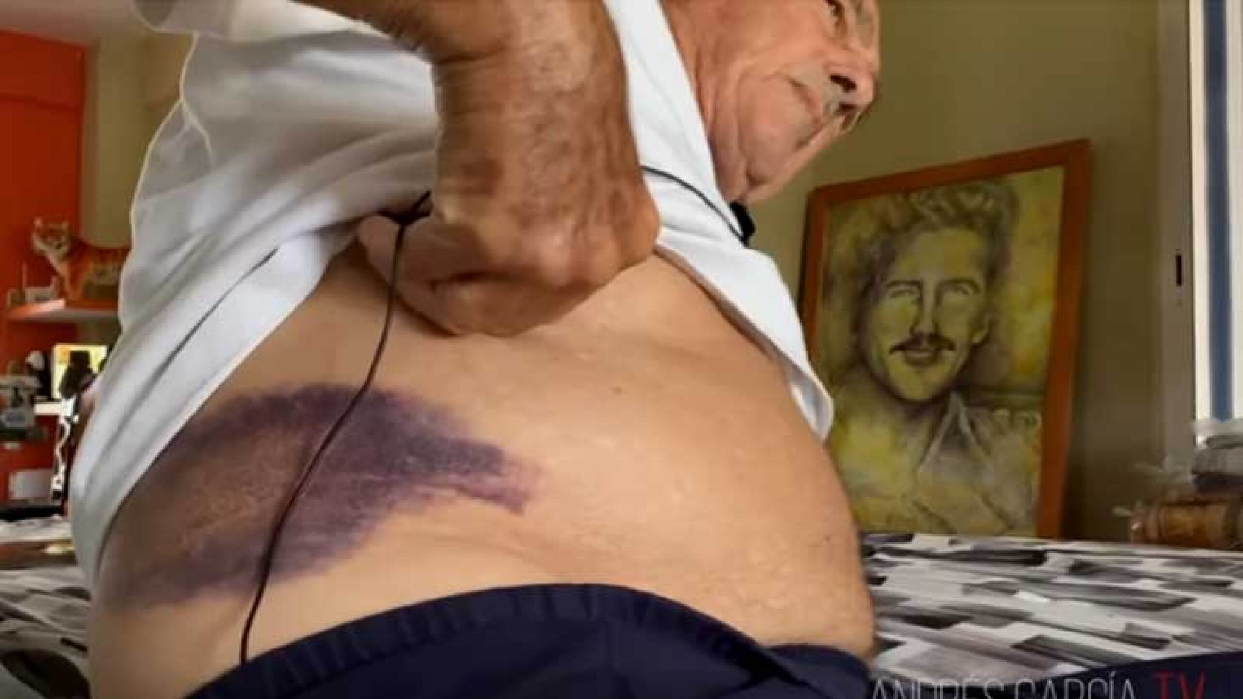 Andrés García sufre lesión que lo mantiene en cama