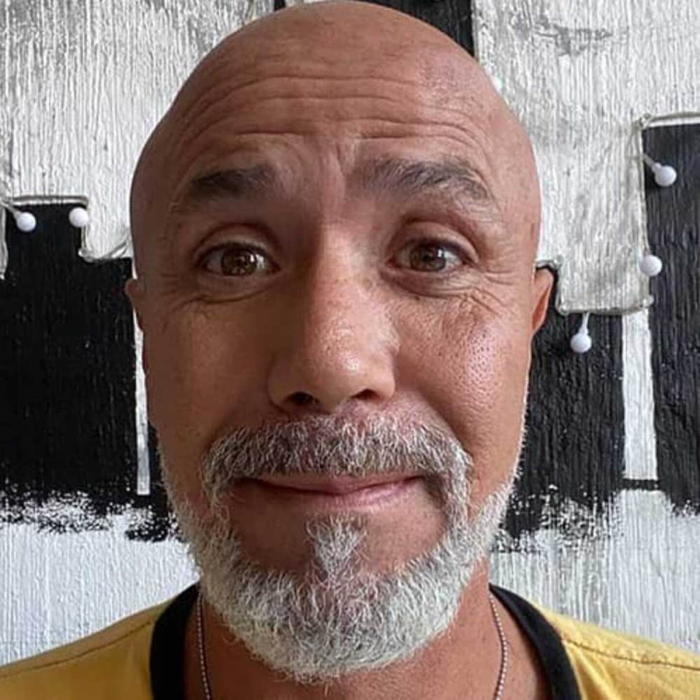 Hospital declara por muerto al exguitarrista de El Tri por error