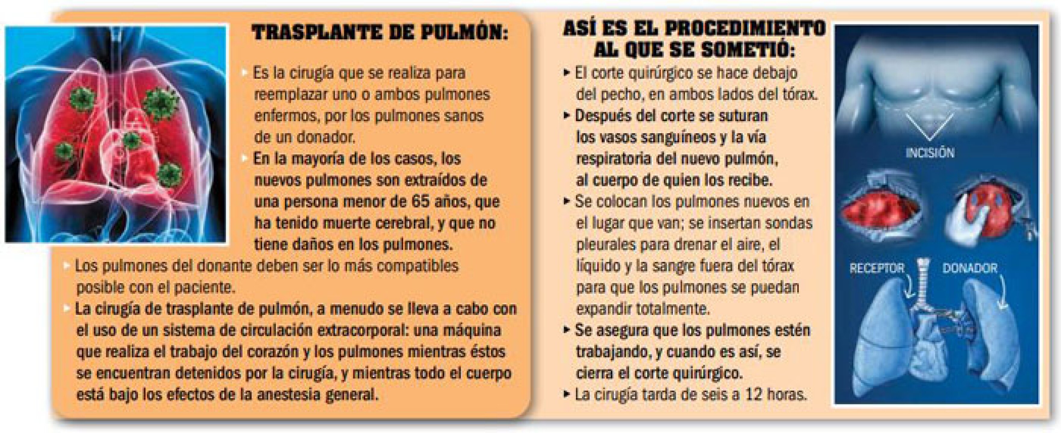 Todo salió muy bien.