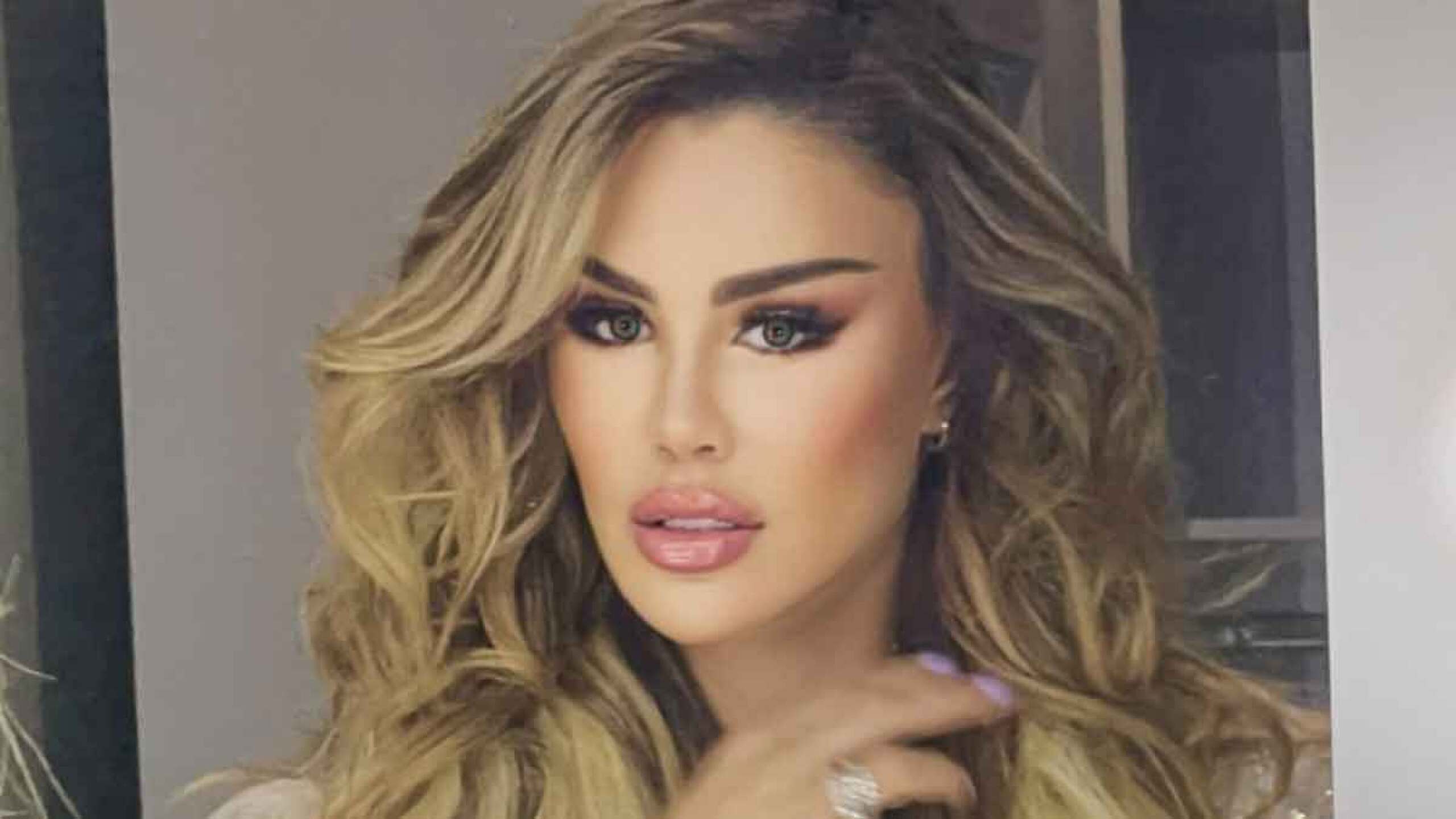 Ninel Conde cambio en su cara