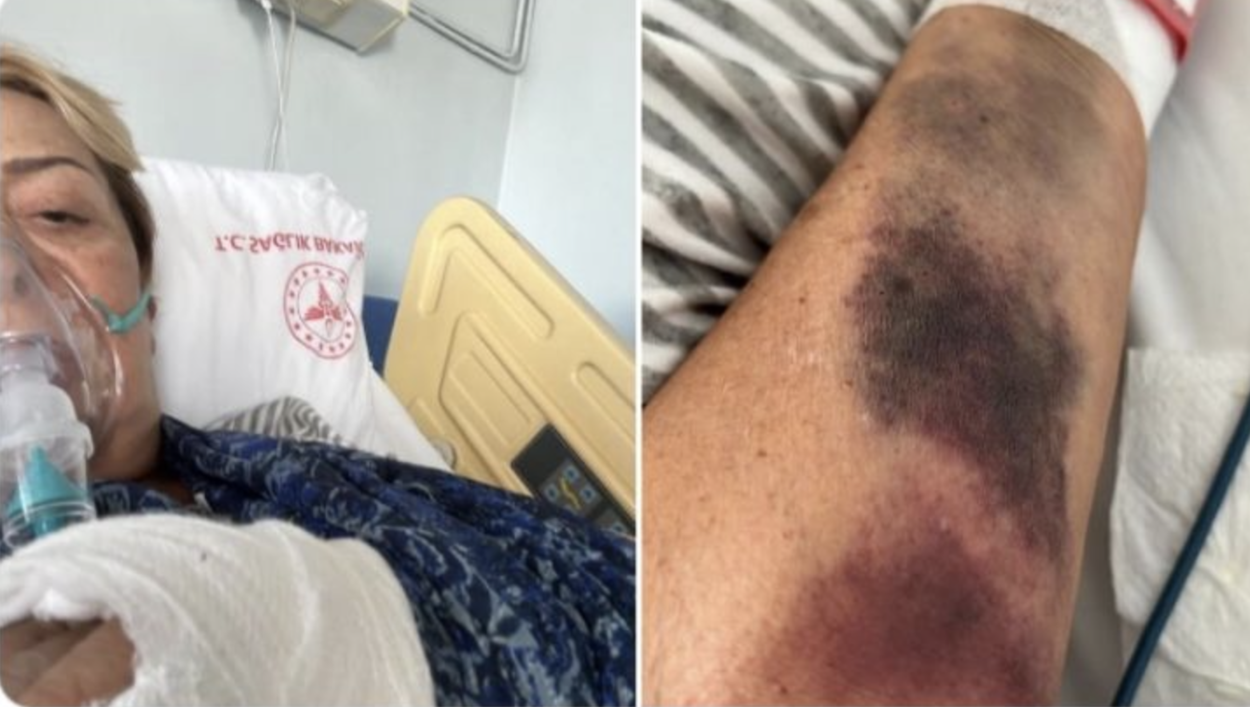 Sylvia Pasquel lesiones caída Turquía