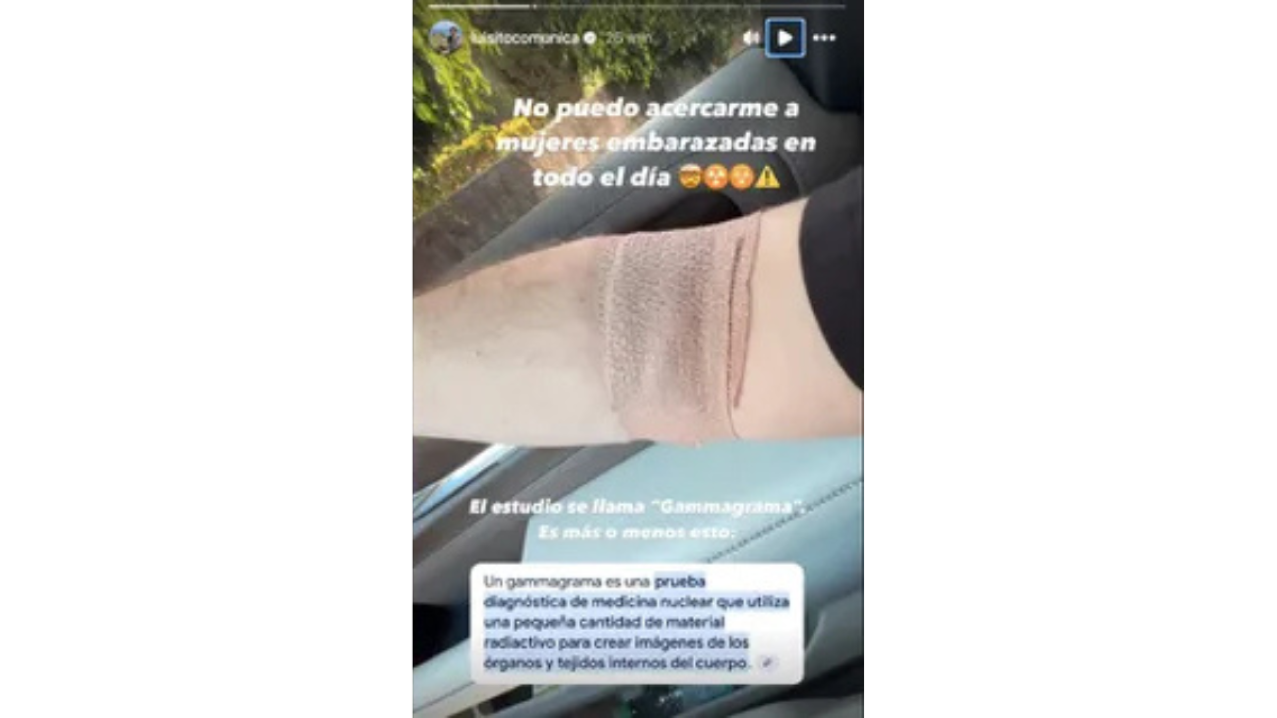 Luisito Comunica se somete a cirugía de columna y recibe tratamiento con material radioactivo