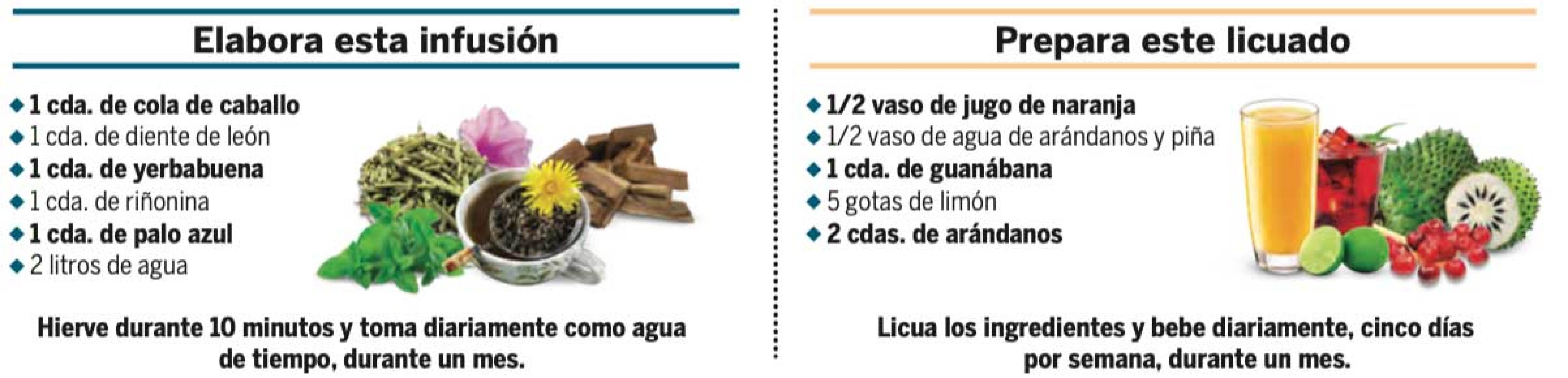 Conoce los síntimas de la pielonefritis