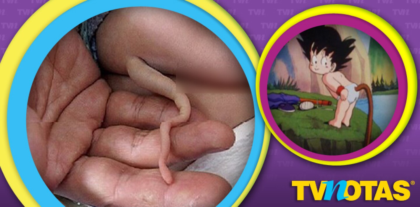 Niño chango causa conmoción en china por tener una cola como la de Gokú.