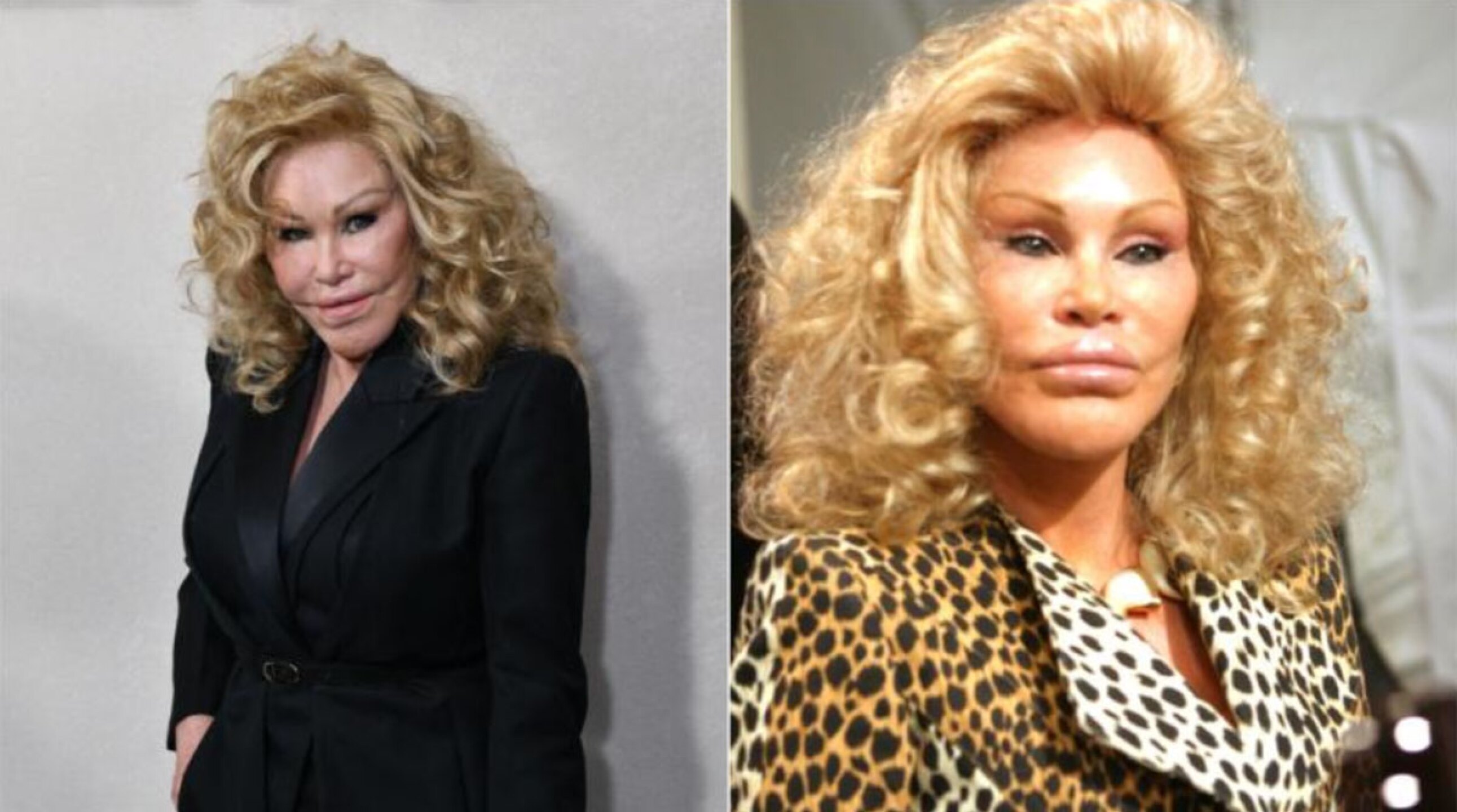 Así lucía Jocelyn Wildenstein actualmente