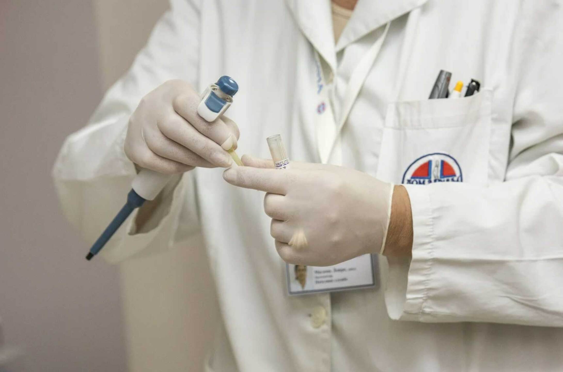 primer caso gripe aviar H10N3 en el mundo china contagio