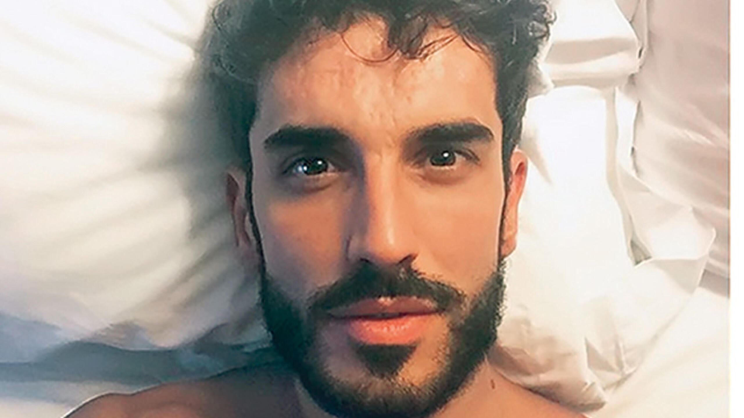 El acné afectó su adolescencia