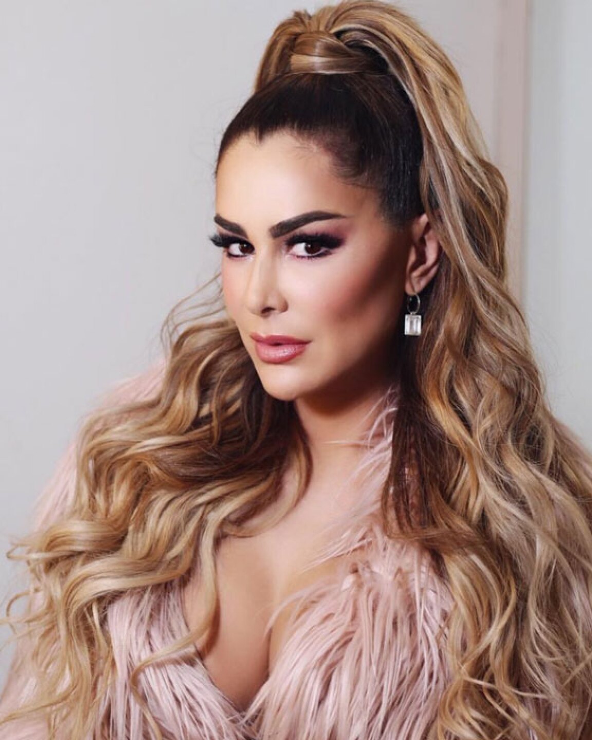 ninel conde fotos golpes moretones