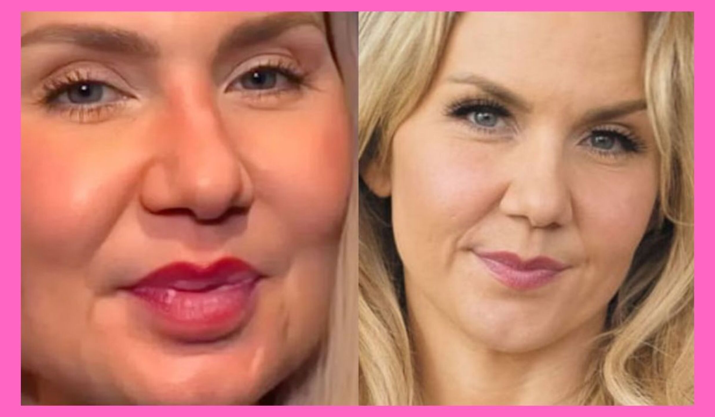 Michelle Vieth antes y después