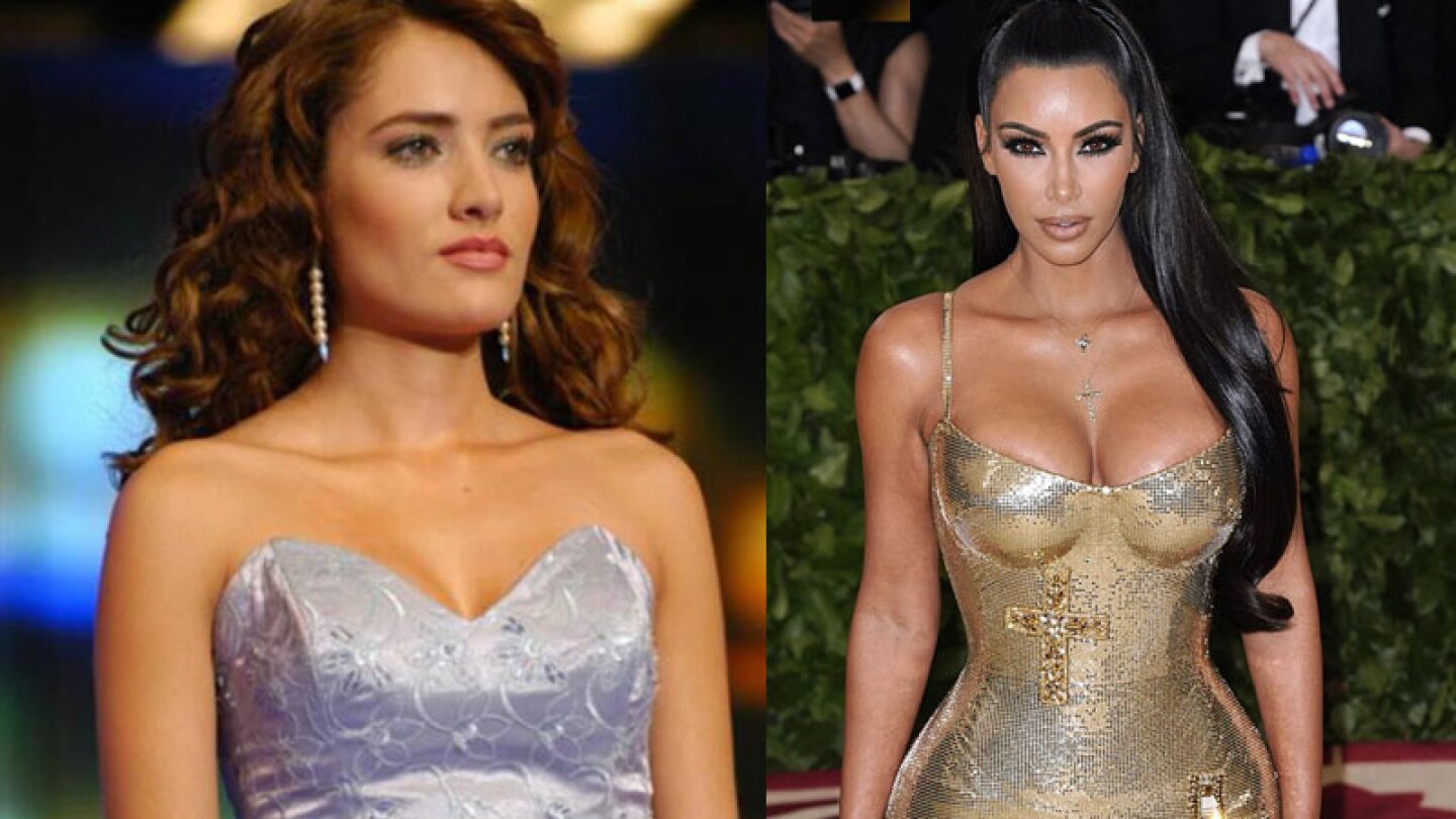 Jolette se inyecta su propia sangre como Kim Kardashian