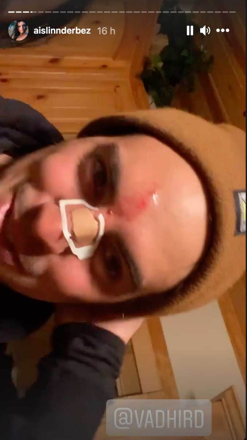 Vadhir Derbez se accidentó