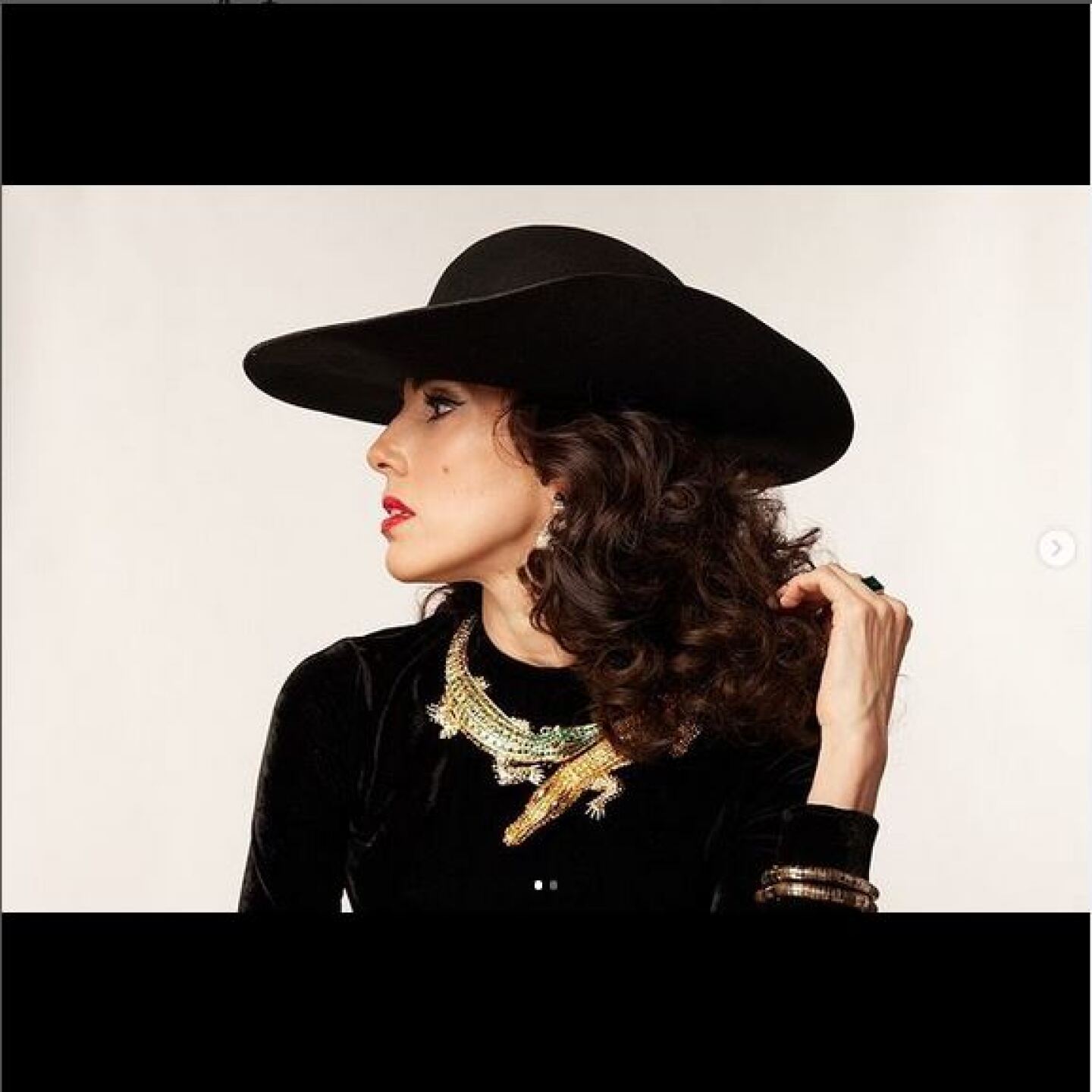 Sandra Echeverría sufre terrible llaga en su pie y comparte el terrible momento