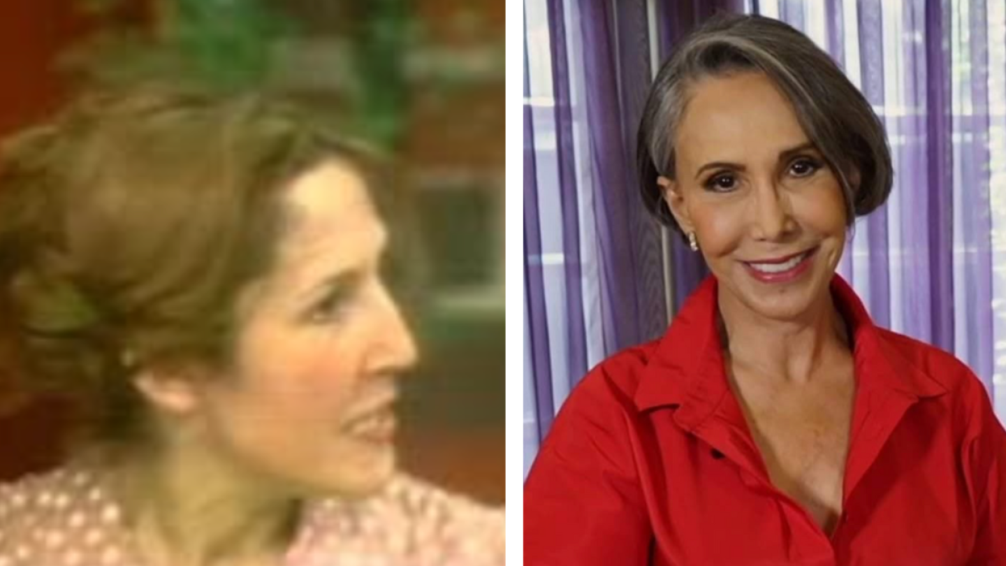 Florinda Meza nariz.png