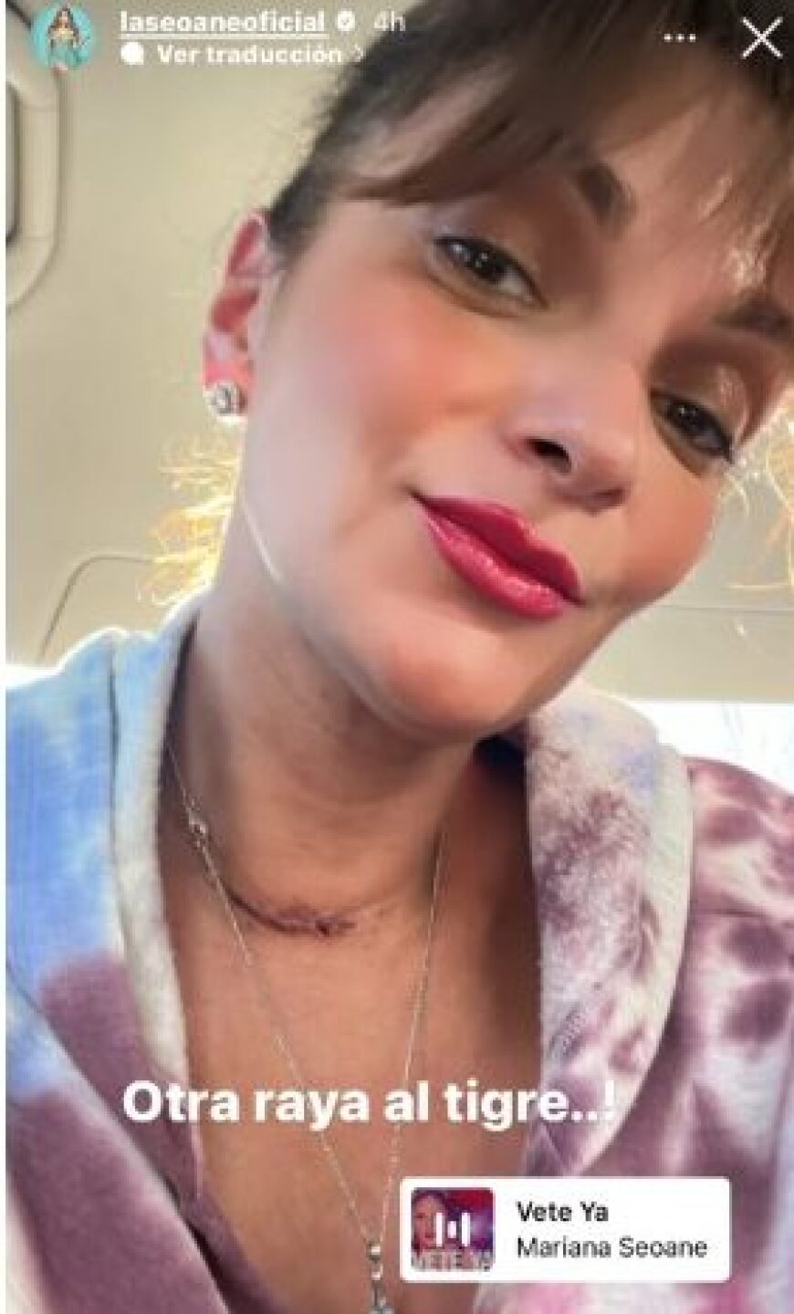 Mariana Seoane confirma que tuvo un tumor que puso en riesgo sus cuerdas vocales