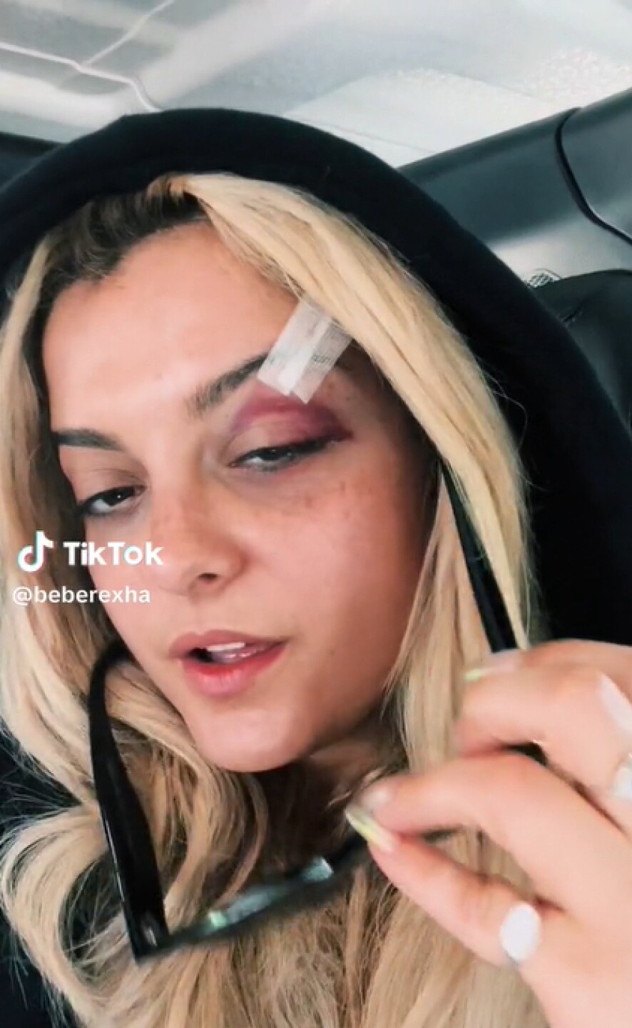 Bebe Rexha agresión