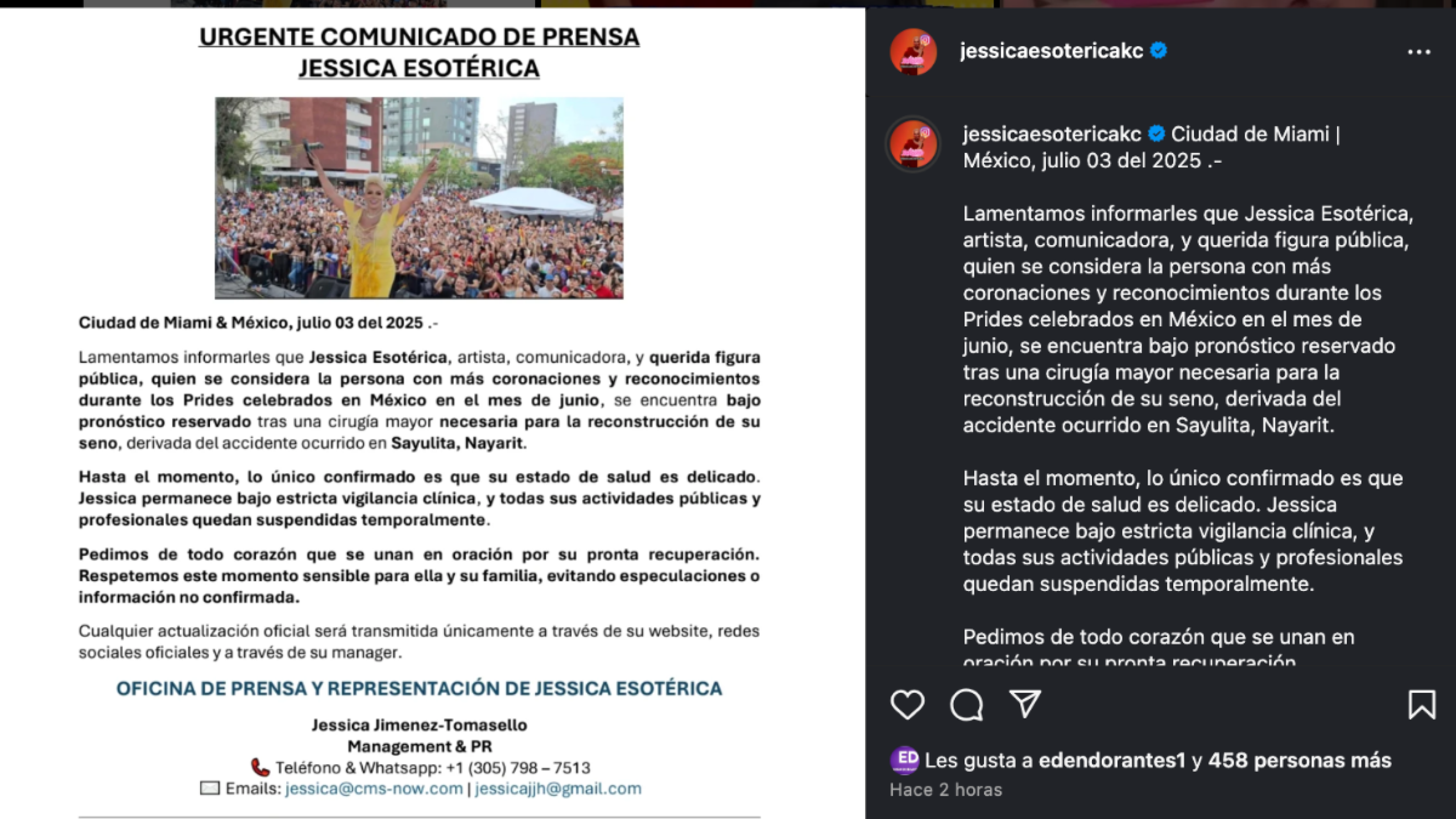 Jessica Esotérica fue hospitalizada de emergencia, ¿le amputaron el seno?